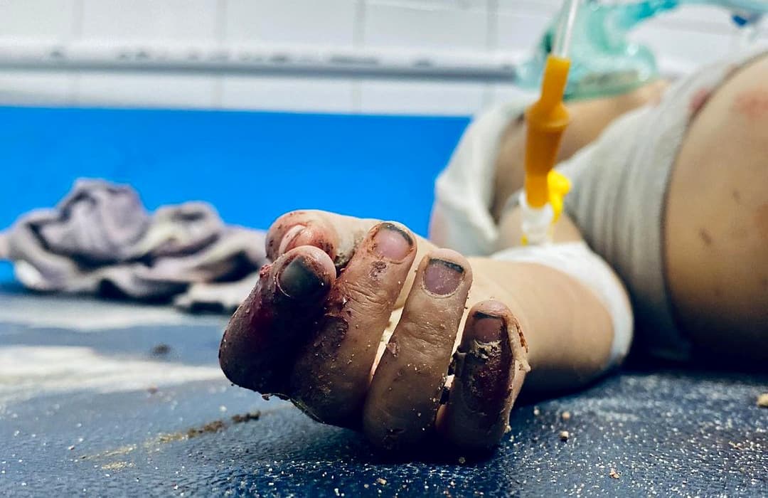A wounded person receiving medical care